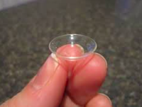  Inserting scleral contact lenses using the tripod method